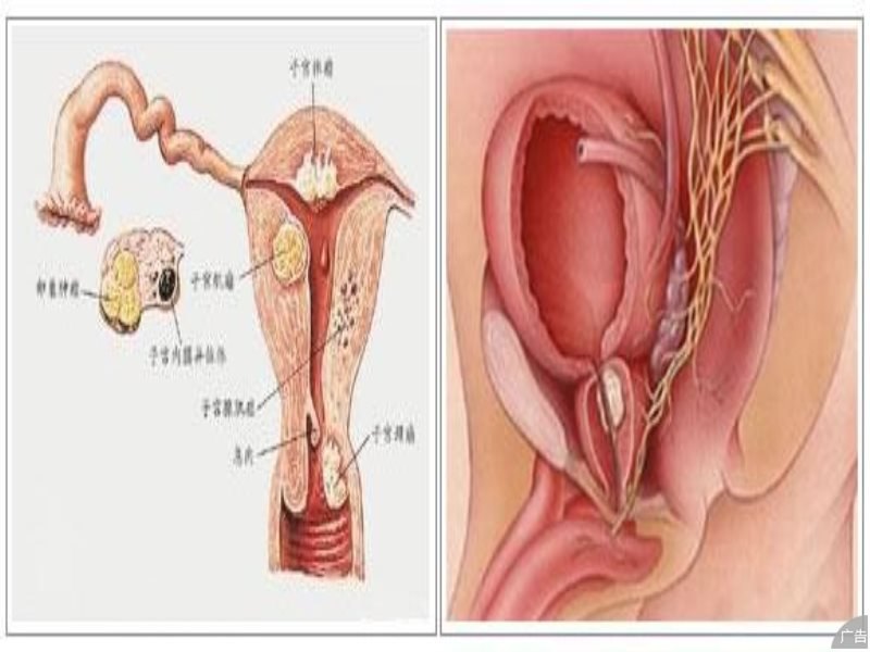 外阴囊肿的症状有哪些?